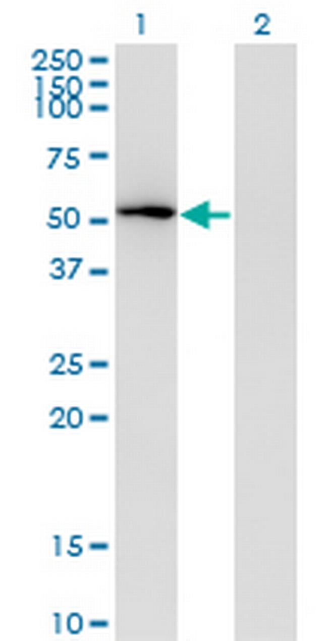 MAPK8 Antibody in Western Blot (WB)