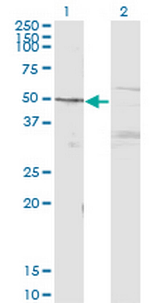 MAPK8 Antibody in Western Blot (WB)