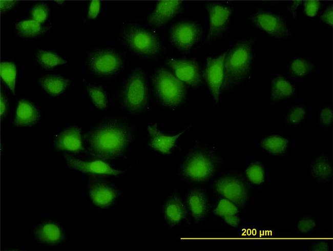 MAPK9 Antibody in Immunocytochemistry (ICC/IF)