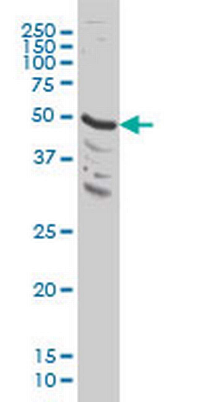 MAPK9 Antibody in Western Blot (WB)