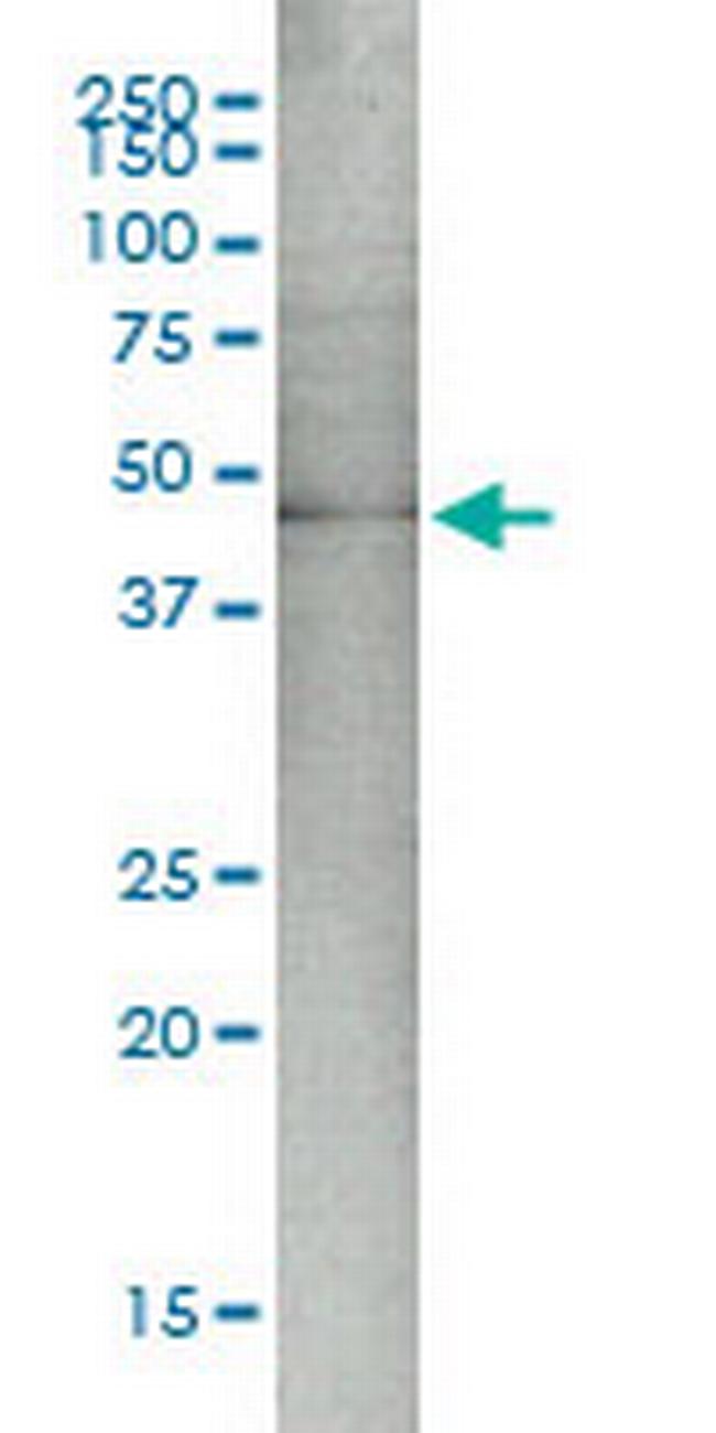 MAP2K5 Antibody in Western Blot (WB)