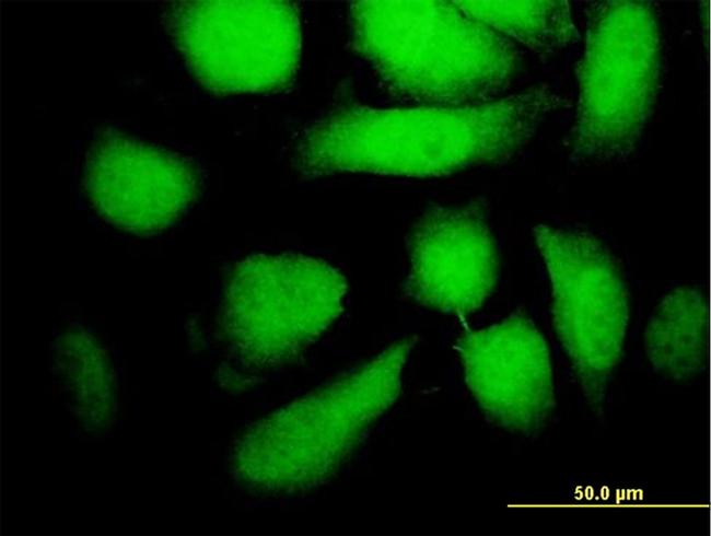 MAP2K5 Antibody in Immunocytochemistry (ICC/IF)