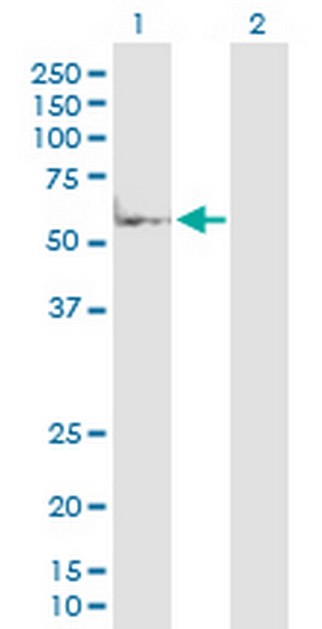 MAP2K7 Antibody in Western Blot (WB)