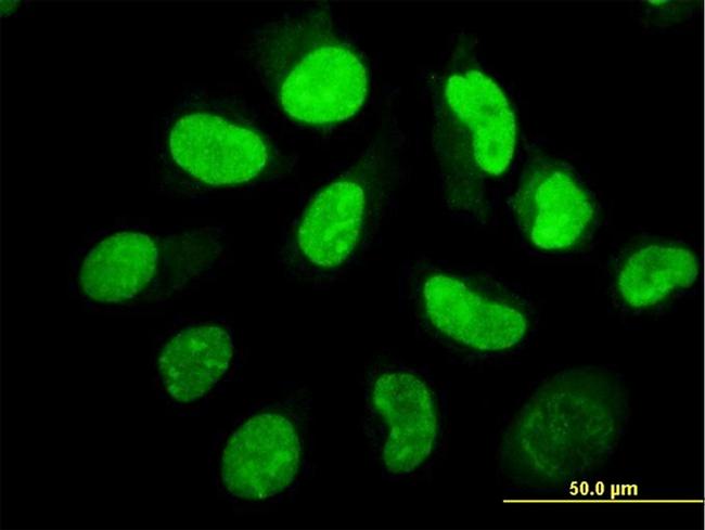 EIF2AK2 Antibody in Immunocytochemistry (ICC/IF)