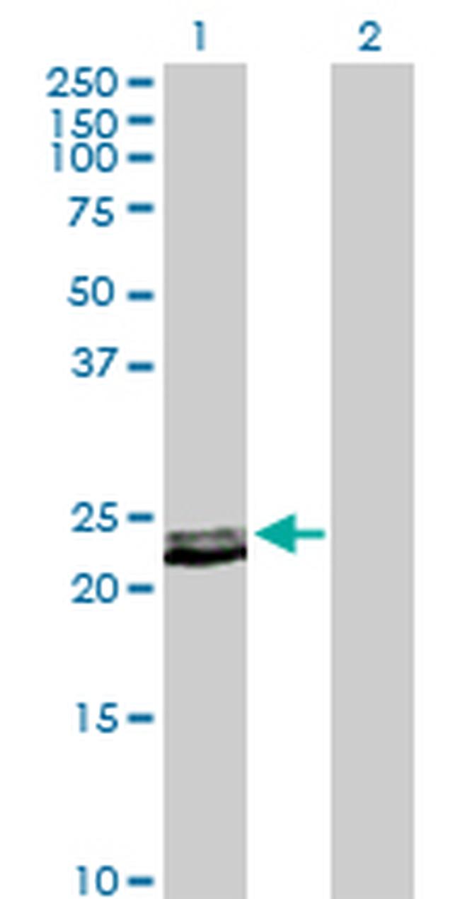 PRL Antibody in Western Blot (WB)