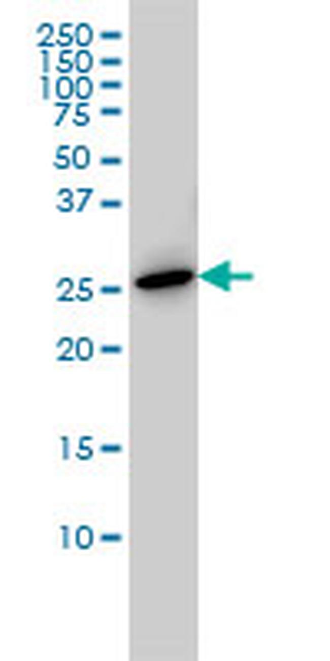 PRL Antibody in Western Blot (WB)