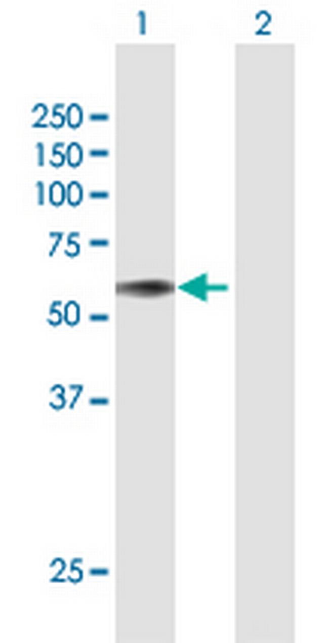 PROC Antibody in Western Blot (WB)