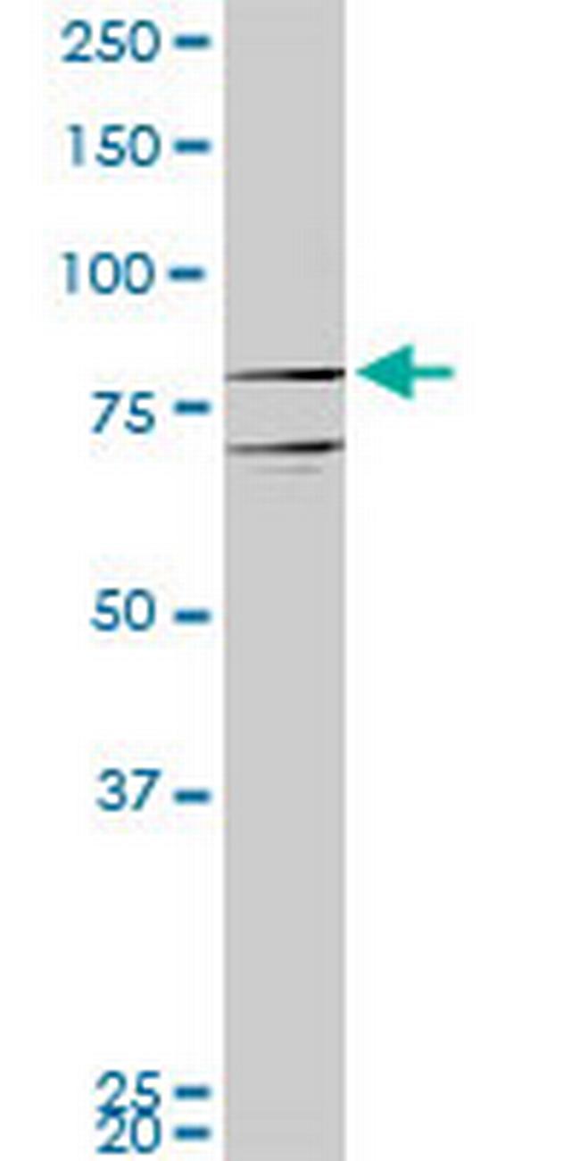 PROX1 Antibody in Western Blot (WB)