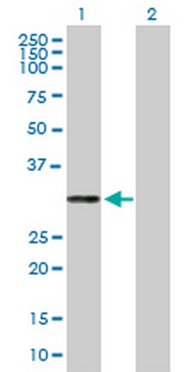 PRTN3 Antibody in Western Blot (WB)