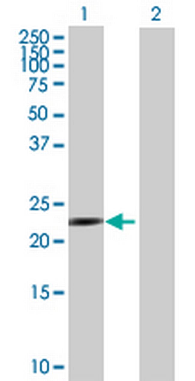 PSMA7 Antibody in Western Blot (WB)