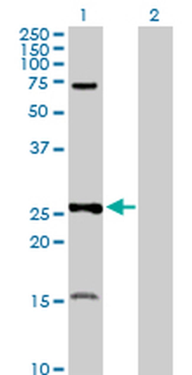 PSMA7 Antibody in Western Blot (WB)