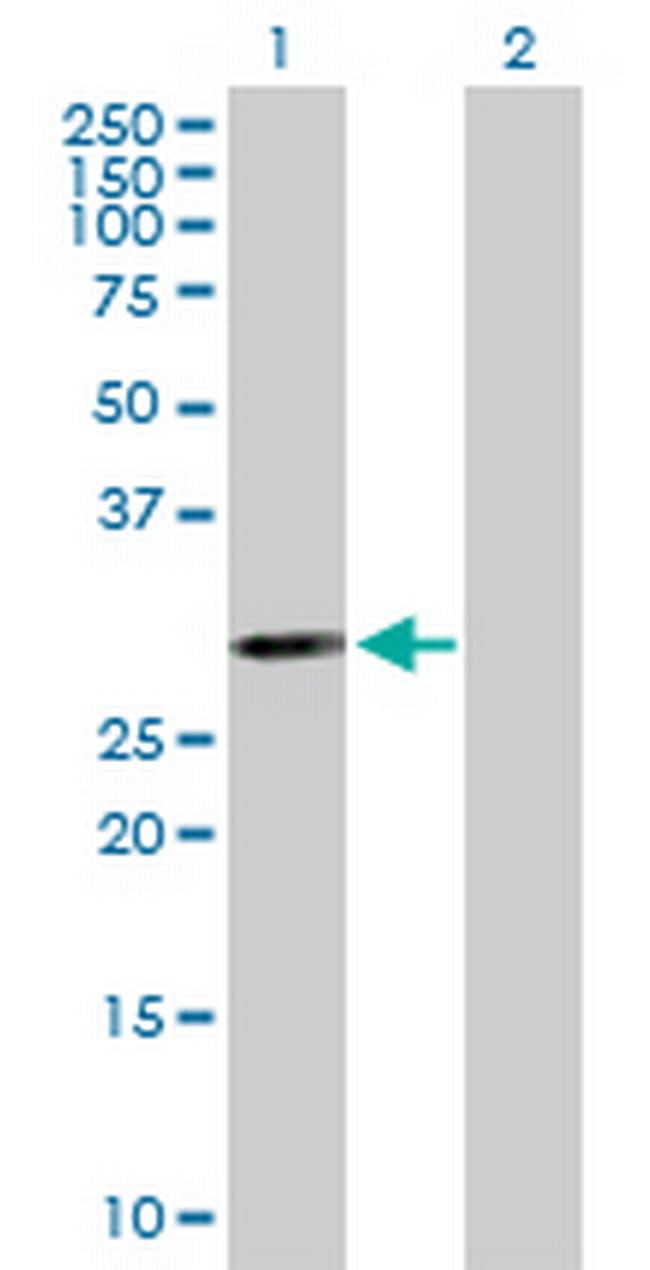 PSMB5 Antibody in Western Blot (WB)