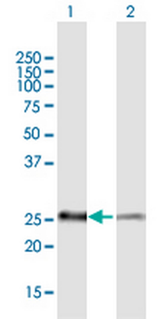 PSMB5 Antibody in Western Blot (WB)