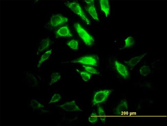 PSMB10 Antibody in Immunocytochemistry (ICC/IF)