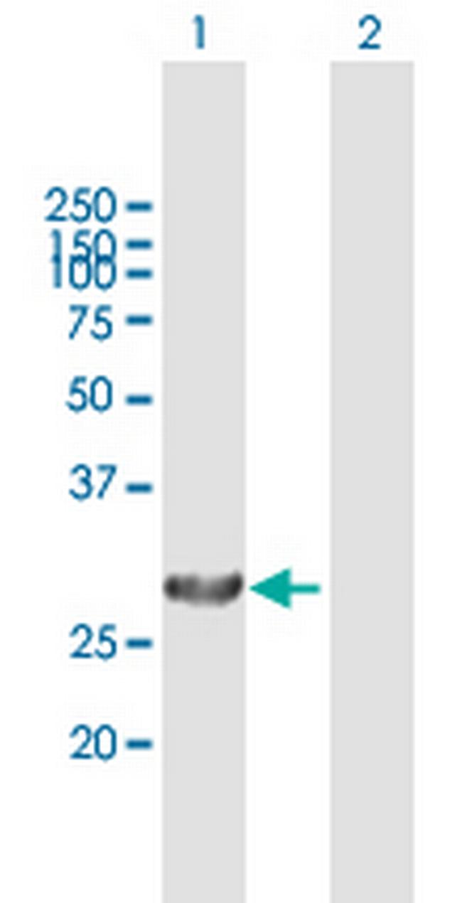 PSME1 Antibody in Western Blot (WB)