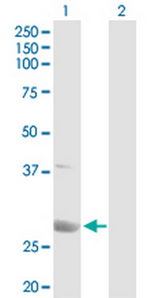 PSME1 Antibody in Western Blot (WB)