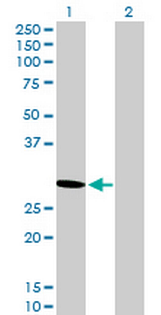 PSME2 Antibody in Western Blot (WB)