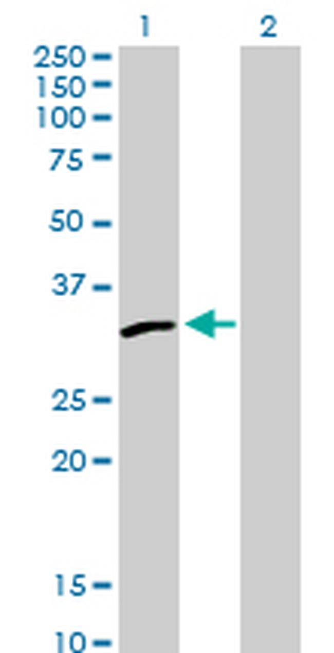 PSME2 Antibody in Western Blot (WB)