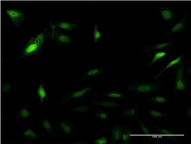 PSME2 Antibody in Immunocytochemistry (ICC/IF)