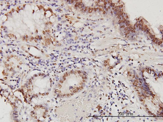 PSME2 Antibody in Immunohistochemistry (Paraffin) (IHC (P))