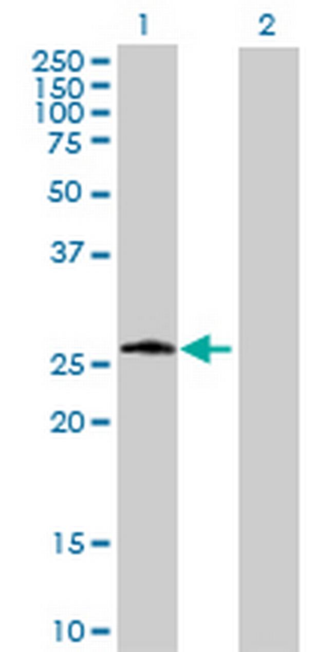 PSPH Antibody in Western Blot (WB)