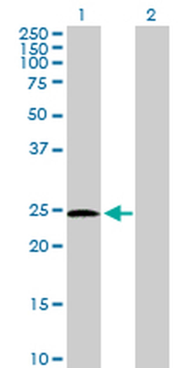 PSPH Antibody in Western Blot (WB)