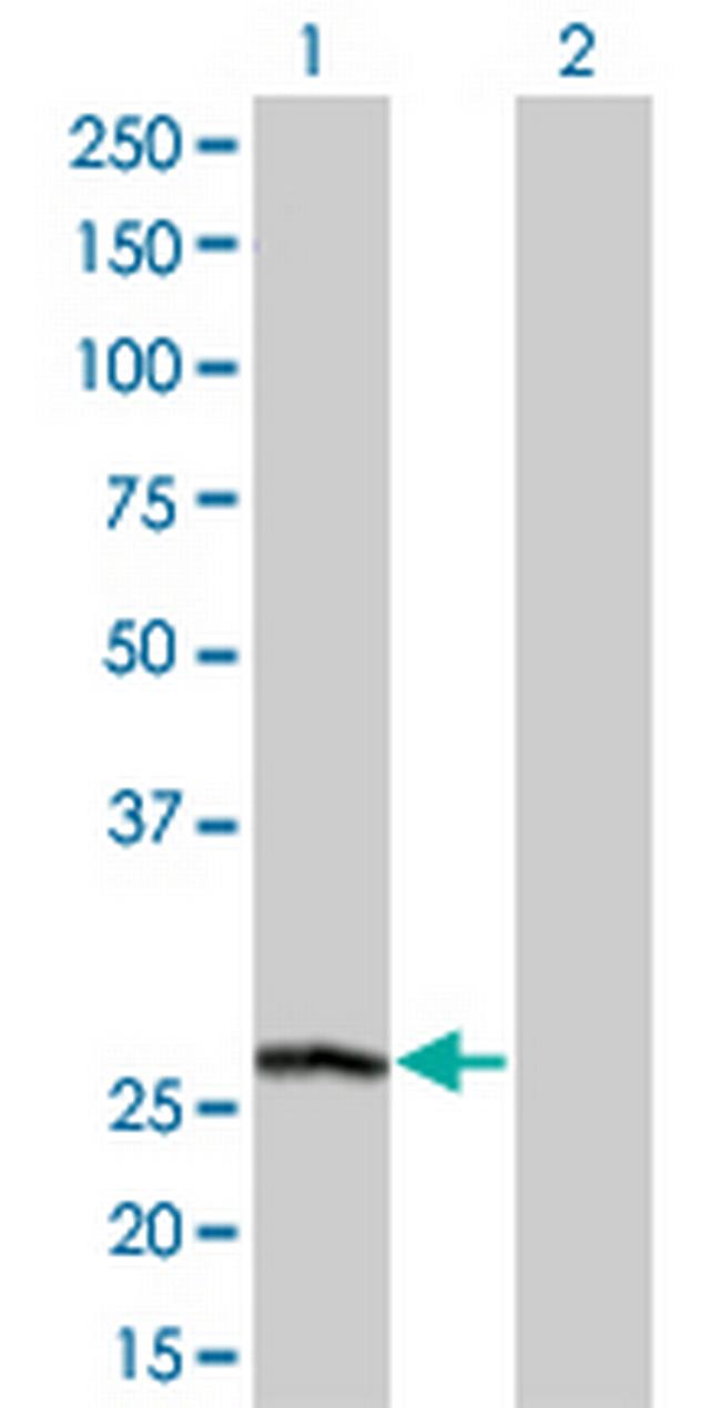 PSPH Antibody in Western Blot (WB)