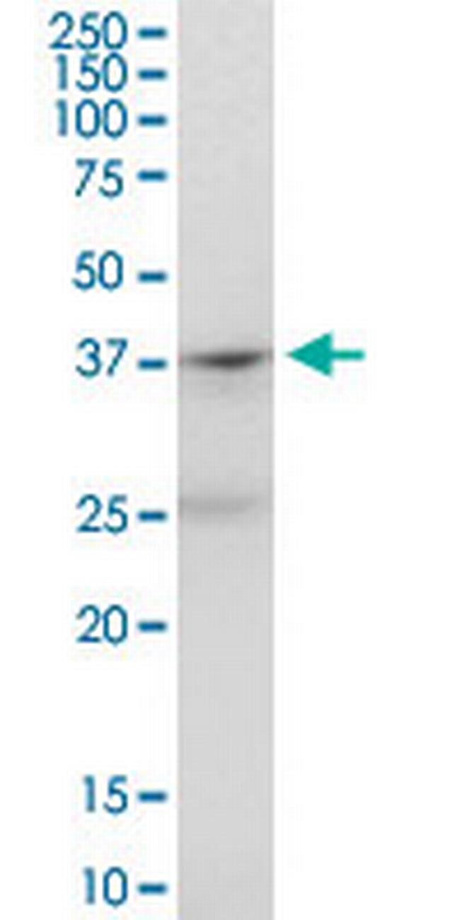 PTAFR Antibody in Western Blot (WB)