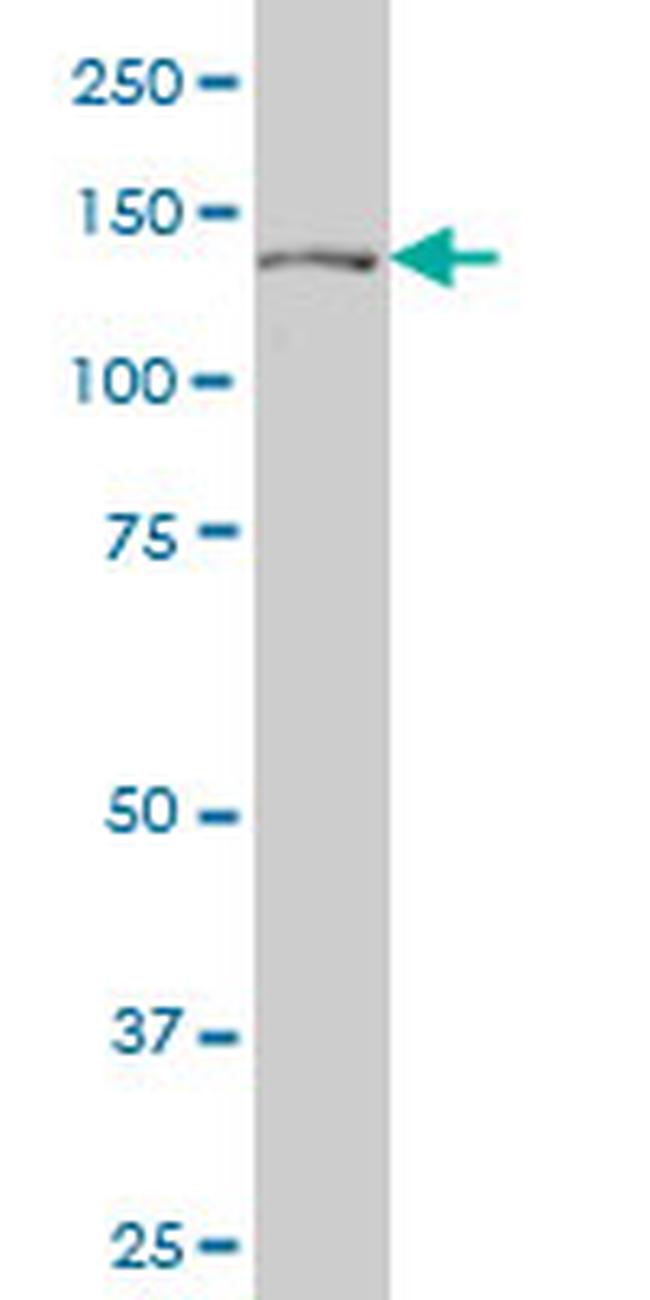 PTCH Antibody in Western Blot (WB)