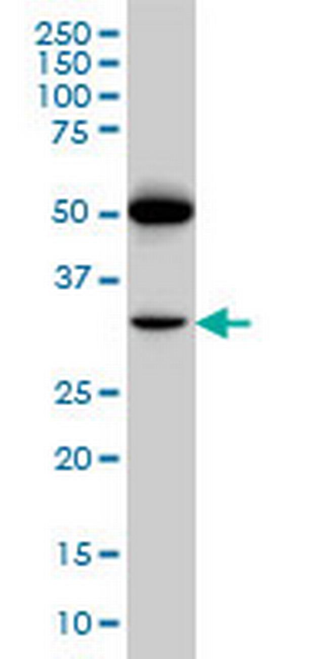 PTGIR Antibody in Western Blot (WB)