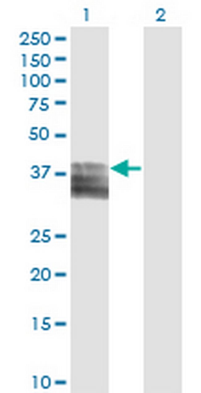 PTGIR Antibody in Western Blot (WB)