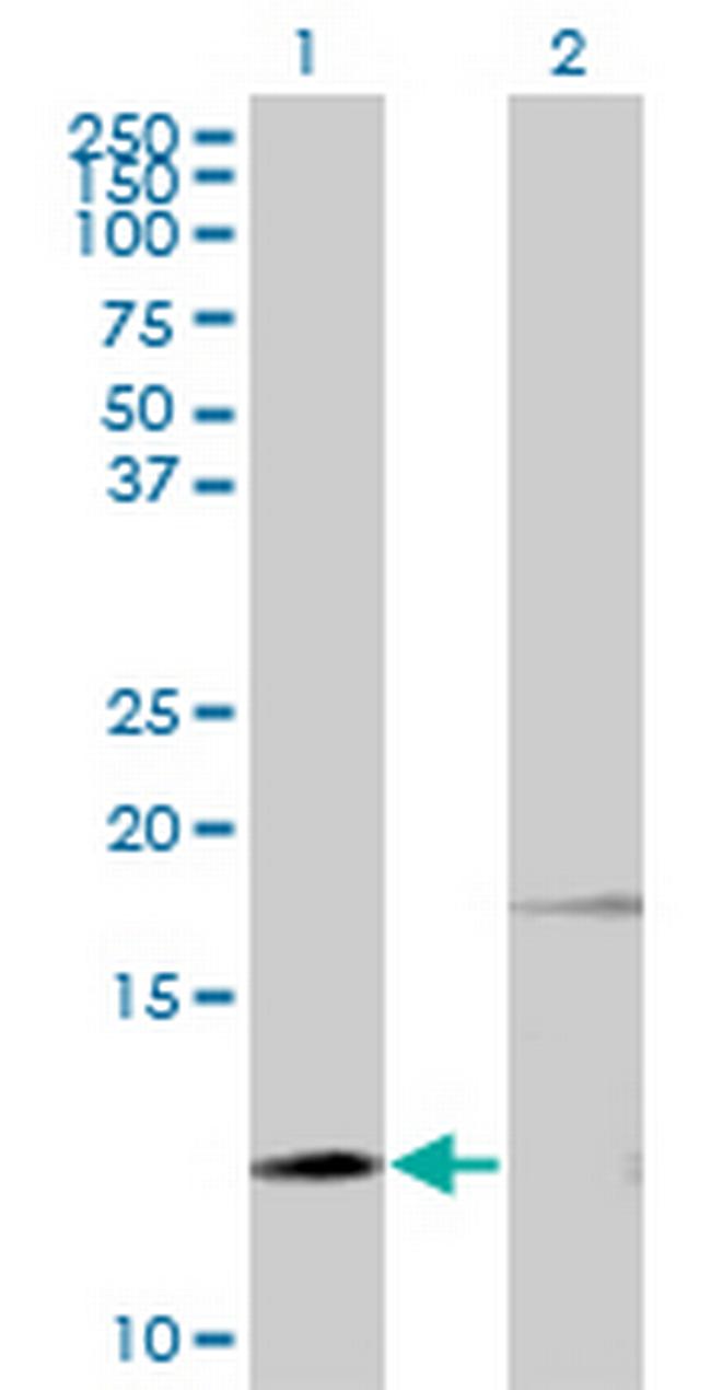 PTH Antibody in Western Blot (WB)