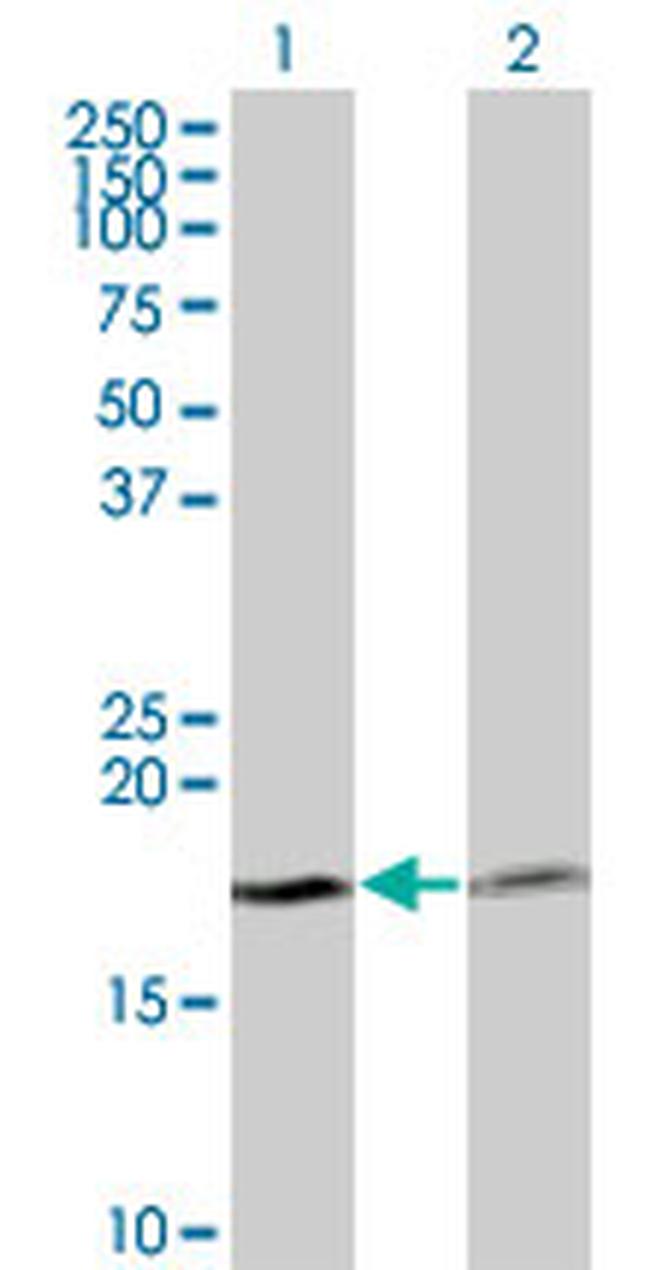 PTH Antibody in Western Blot (WB)