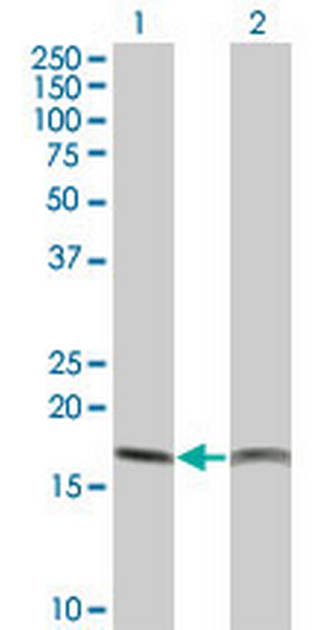 PTH Antibody in Western Blot (WB)