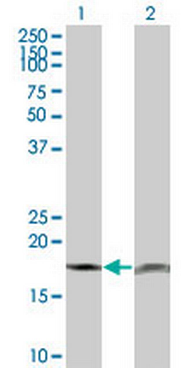 PTH Antibody in Western Blot (WB)