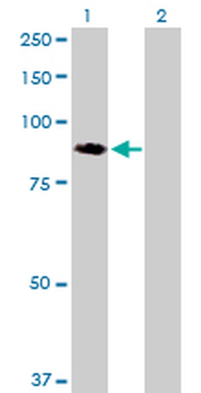 PTK2 Antibody in Western Blot (WB)