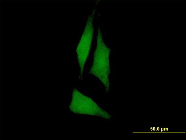 PTK6 Antibody in Immunocytochemistry (ICC/IF)