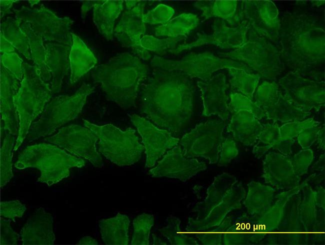 PTK7 Antibody in Immunocytochemistry (ICC/IF)