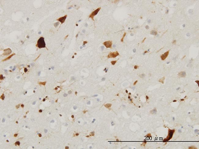 PTN Antibody in Immunohistochemistry (Paraffin) (IHC (P))