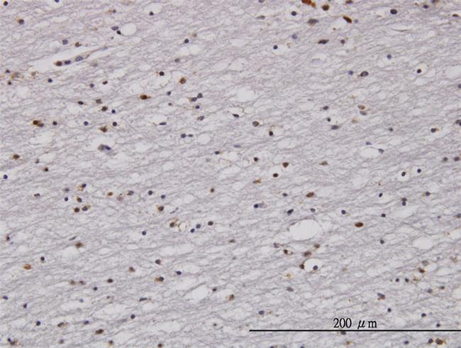 RAD1 Antibody in Immunohistochemistry (Paraffin) (IHC (P))