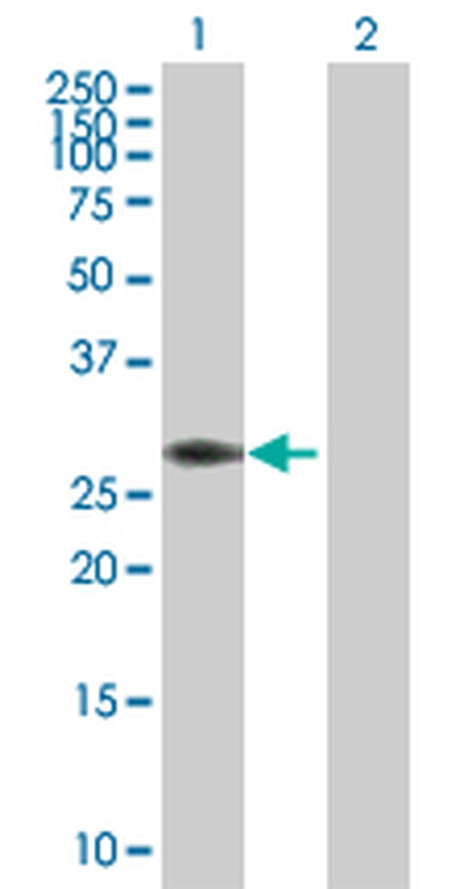 PYCR1 Antibody in Western Blot (WB)