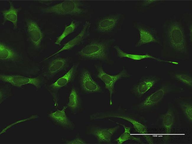 QARS Antibody in Immunocytochemistry (ICC/IF)