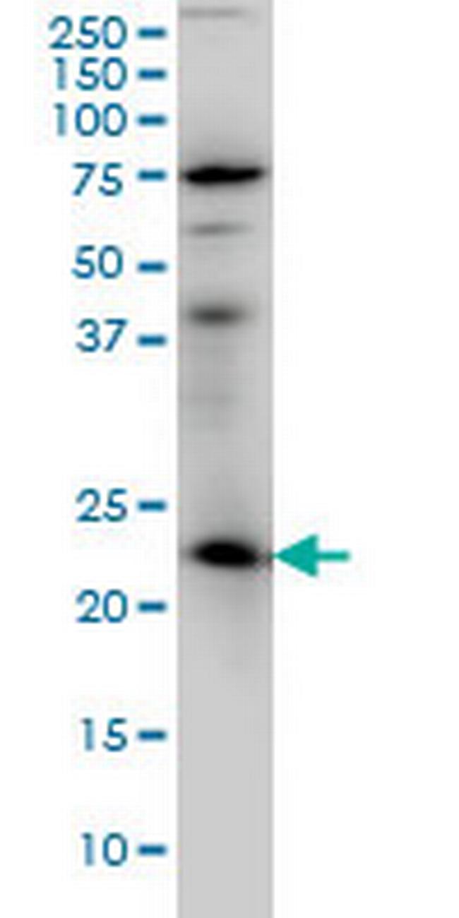 RAB3A Antibody in Western Blot (WB)