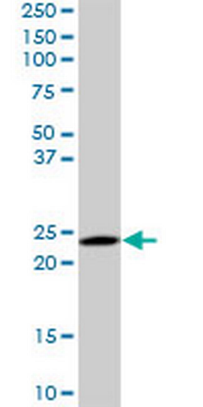 RAB6A Antibody in Western Blot (WB)