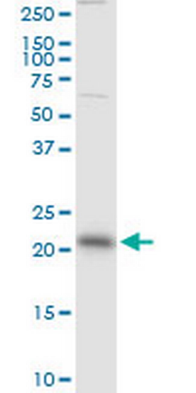 RAB13 Antibody in Western Blot (WB)