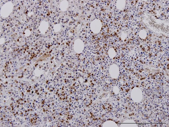 RAB27A Antibody in Immunohistochemistry (Paraffin) (IHC (P))