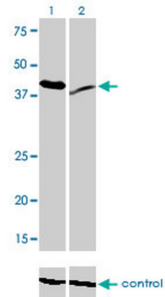 RAD23A Antibody in Western Blot (WB)