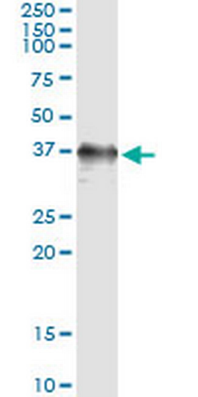 RAD51 Antibody in Immunoprecipitation (IP)