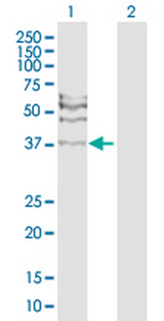 RAD51C Antibody in Western Blot (WB)