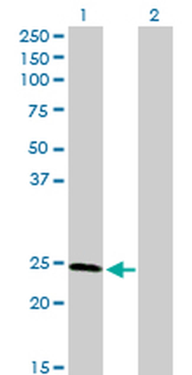 RAD51L3 Antibody in Western Blot (WB)